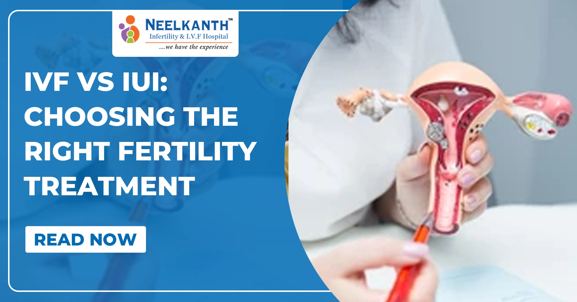 IVF vs IUI: Choosing the Right Fertility Treatment